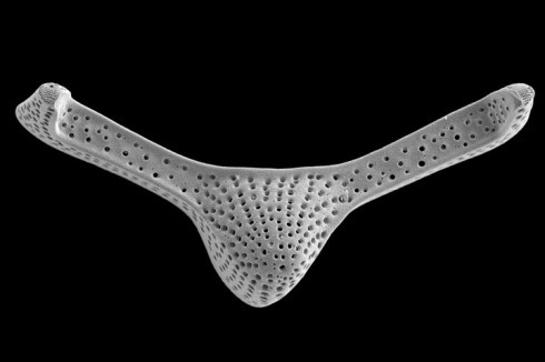 ... und bestehen aus Siliziumoxid.<br /><a href="http://ultrastruktur.bio.lmu.de/de/forschung/index.html" >Biozentrum der LMU München, Ultrastrukturforschung</a><br />