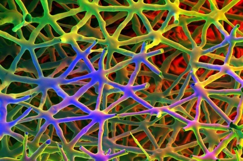 Die sternförmigen Zellen im Durchlüftungsgewebe der Flatterbinse sind miteinander verbunden.<br />